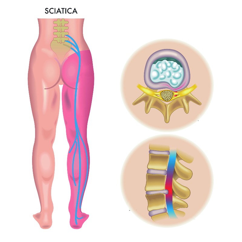 Sciatic Nerve